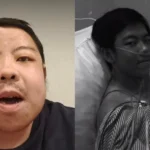 The Silent Threat: How Autoimmune Disease Forced a Jakarta Teenager Into Lifelong Dialysis